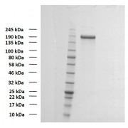 SDS-PAGE analysis of recombinant SARS-CoV-2 Spike Glycoprotein (D614G Mutation).