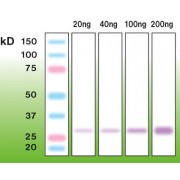 Western blot analysis of human trypsin isolated from human pancreas.