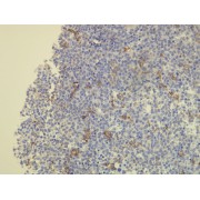IHC-P analysis showing CD163 expression in the macrophages of the bone marrow (4 µm section).