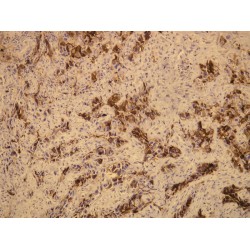 Mucin 1 (MUC1) Antibody