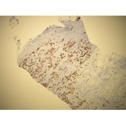 Keratin, Type II Cytoskeletal 7 (KRT7) Antibody