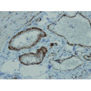 IHC-P analysis of alpha smooth muscle actin positivity in the vessel walls of submucosa of small intestine tissue (4 µm section).
