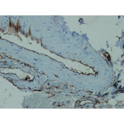 Hematopoietic Progenitor Cell Antigen CD34 (CD34) Antibody