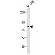 WB analysis of Mouse lung tissue lysate (20 µg/lane), using RHBDF2 antibody (1/2000 dilution). Predicted band size: 97 kDa. Blocking/Dilution buffer: 5% NFDM/TBST.
