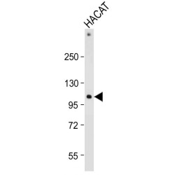 Inactive Rhomboid Protein 2 (RHBDF2) Antibody