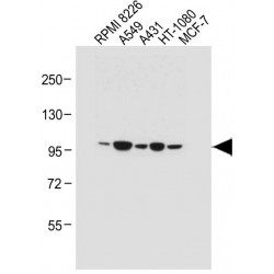 Inactive Rhomboid Protein 2 (RHBDF2) Antibody
