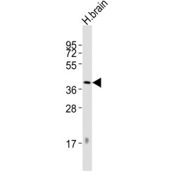Dopamine Receptor D2 (DRD2) Antibody