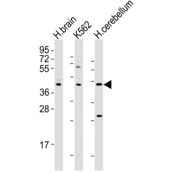Dopamine Receptor D2 (DRD2) Antibody