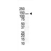 Ubiquitin Specific Peptidase 8 (USP8) Antibody