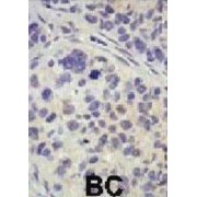 Ubiquitin Specific Peptidase 8 (USP8) Antibody