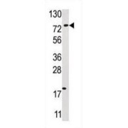 Ubiquitin Carboxyl-Terminal Hydrolase 16 (USP16) Antibody