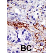 Ubiquitin Carboxyl-Terminal Hydrolase 21 (USP21) Antibody