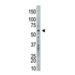 Ubiquitin Carboxyl-Terminal Hydrolase 21 (USP21) Antibody