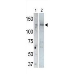 Ubiquitin Carboxyl-Terminal Hydrolase 25 (USP25) Antibody