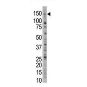 Ubiquitin Carboxyl-Terminal Hydrolase 28 (USP28) Antibody