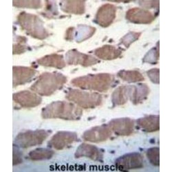 Ubiquitin Carboxyl-Terminal Hydrolase 29 (USP29) Antibody