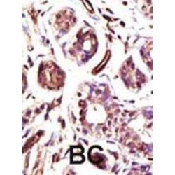 Ubiquitin Protein Ligase E3A (UBE3A) Antibody