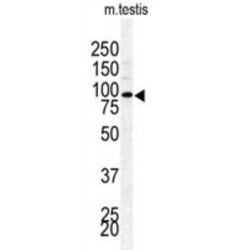 Ubiquitin Carboxyl-Terminal Hydrolase BAP1 (BAP1) Antibody