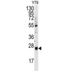 Ubiquitin-Conjugating Enzyme E2 E3 (UBCH9) Antibody