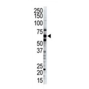 DSK2 Homolog (UBQLN2) Antibody