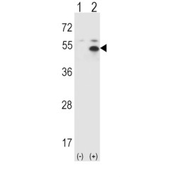 Signal Transducing Adaptor Molecule (STAM) Antibody