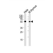 Serine/threonine-Protein Kinase Chk1 (CHK1) Antibody