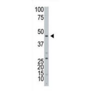 Ecto-ADP-Ribosyltransferase 3 (ART3) Antibody