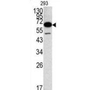 Methionine Aminopeptidase 2 (METAP2) Antibody