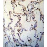 Advanced Glycosylation End Product-Specific Receptor (AGER) Antibody