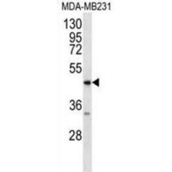 Advanced Glycosylation End Product-Specific Receptor (AGER) Antibody