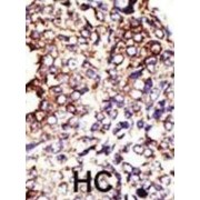 abx031589