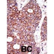 abx031590