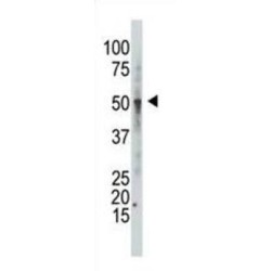 Beta-1,3-Galactosyl-O-Glycosyl-Glycoprotein Beta-1,6-N-Acetylglucosaminyltransferase (GCNT1) Antibody