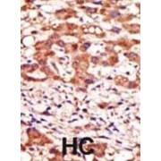 Mannosyl (Alpha-1,3-)-Glycoprotein Beta-1,2-N-Acetylglucosaminyltransferase (MGAT1) Antibody