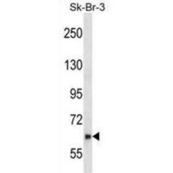 Negative Regulator of Ubiquitin-Like Proteins 1 (NYREN18) Antibody