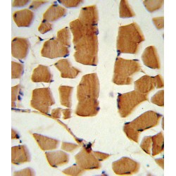 Polycomb Complex Protein BMI-1 (BMI1) Antibody