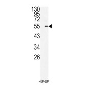 WB analysis of 293 cell lysates (35 µg), using BMI1 antibody.