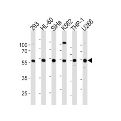 Yin Yang 1 (YY1) Antibody