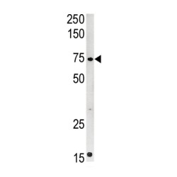 Carnitine Palmitoyltransferase 2, Mitochondrial (CPT2) Antibody