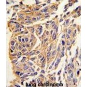 Palmitoyl-Protein Thioesterase 1 (PPT1) Antibody