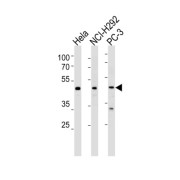 DSS-AHC Critical Region On The X Chromosome Protein 1 (DAX1) Antibody