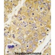 Dystrobrevin Binding Protein 1 (Dtnbp1) Antibody
