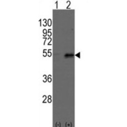 Dystrobrevin Binding Protein 1 (Dtnbp1) Antibody