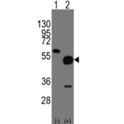 Neuronal Pentraxin-2 (NPTX2) Antibody