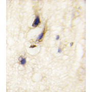Disheveled-Associated Activator of Morphogenesis 1 (DAAM1) Antibody
