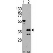 Zinc Finger Protein ZIC 4 (ZIC4) Antibody