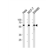 Krueppel-Like Factor 4 (KLF4) Antibody