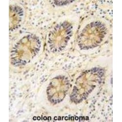 Aldose Reductase (AKR1B1) Antibody