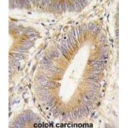 Aldose Reductase (AKR1B1) Antibody