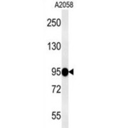 Semaphorin 6A (SEMA6A) Antibody